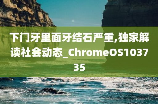 下门牙里面牙结石严重,独家解读社会动态_ChromeOS103735